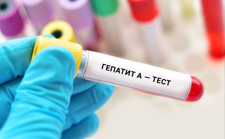 У мешканця Львівщини діагностували гепатит А після випитої води з джерела
