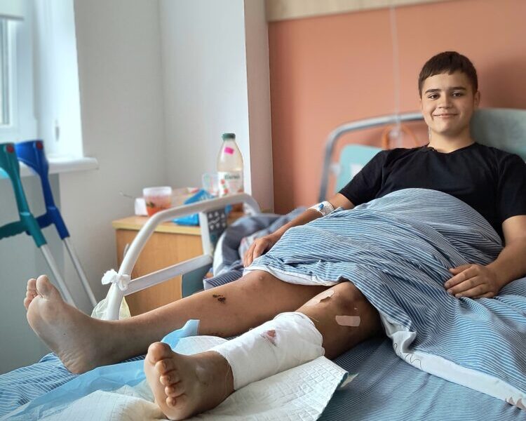 На Львівщині зросла кількість підлітків, які потрапляють у ДТП на скутерах та мотоциклах
