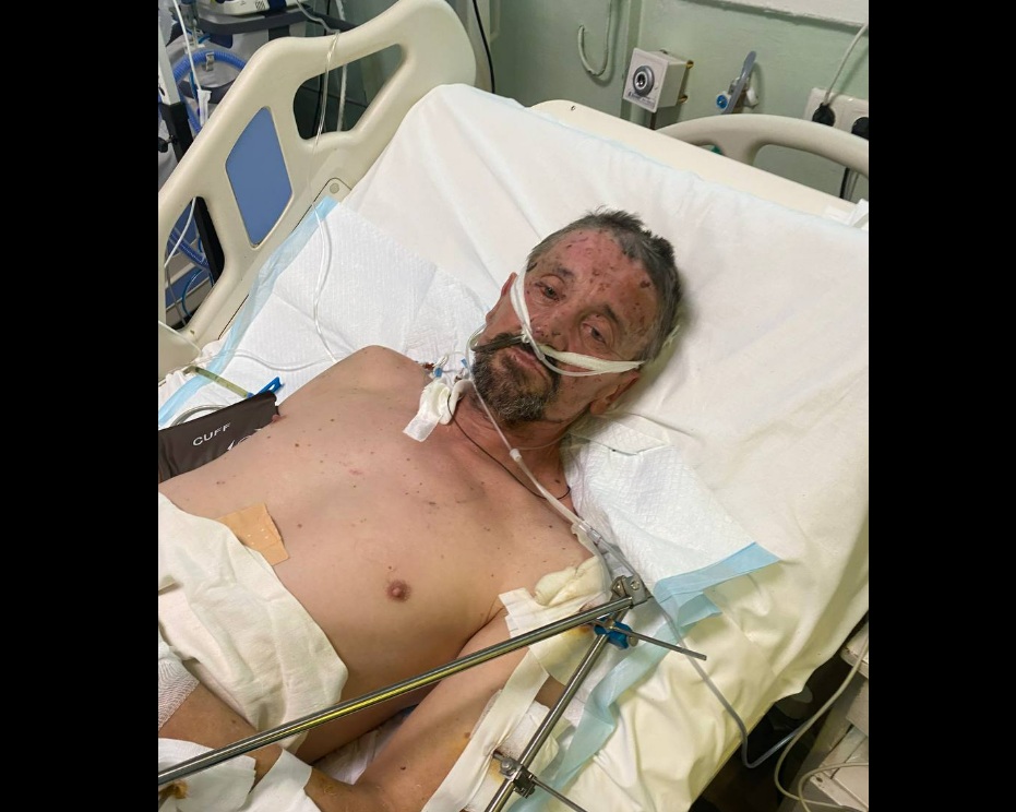 Ексфутболіст львівських «Карпат» Микола Закотюк отримав важке поранення на фронті — родина просить допомоги