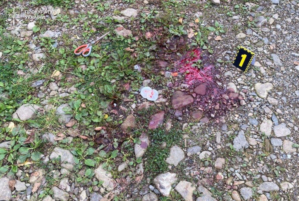 На Львівщині нетверезий чоловік поранив сусіда з двоствольної рушниці