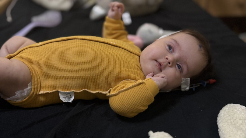 Львівські медики успішно видалили небезпечну пухлину мозку у двомісячної дівчинки