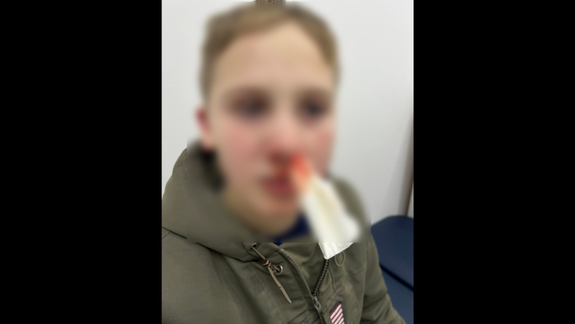 У Львові затримали чоловіка, який напав на 11-річного школяра