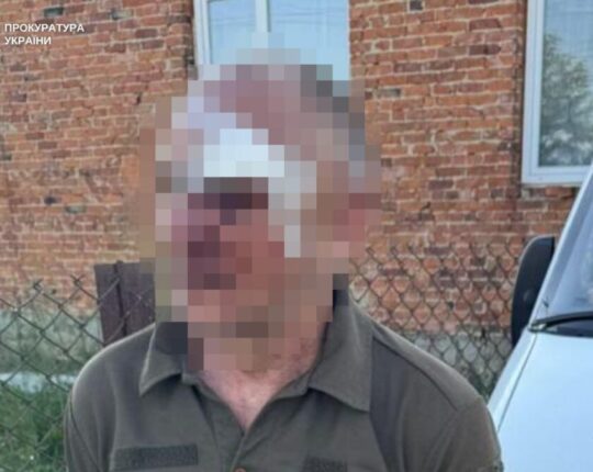 На Львівщині чоловік поранив тещу