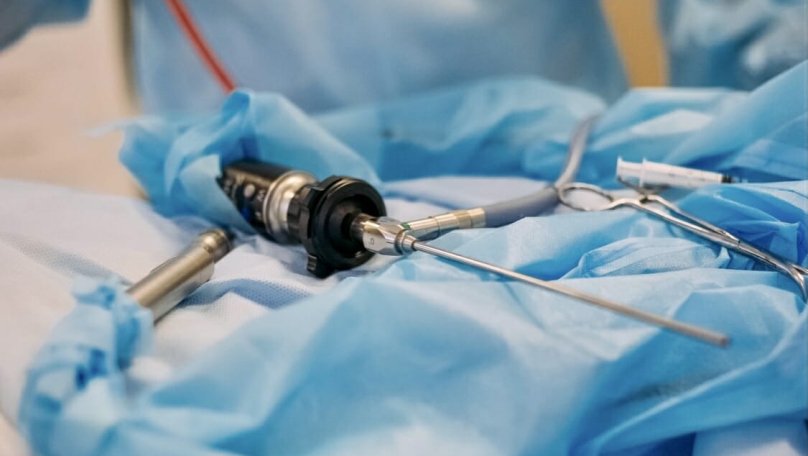 У Львові медики Університетської лікарні видалили 46-річній жінці кісту розміром з кавун