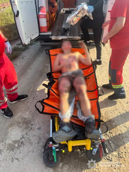У Львові підліток заліз на вагон заради селфі та отримав сильні опіки